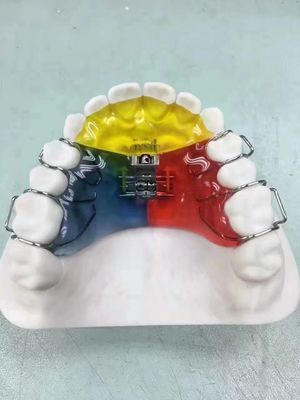 Nance / Hyrax / Rapid Palatal Expander Night Guard Space Keeper OEM An toàn để sử dụng