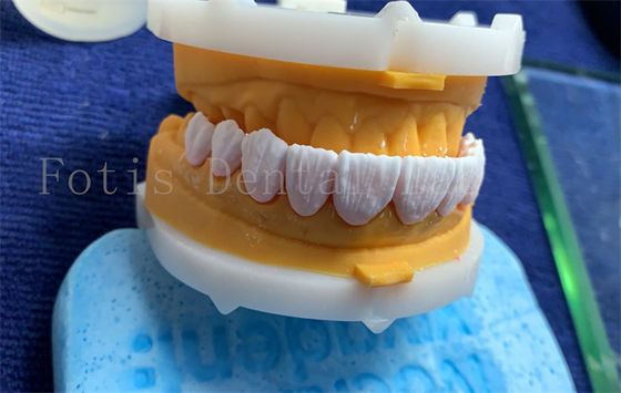 Vương miện răng kỹ thuật số tiên tiến cấy ghép vương miện răng FDA / ISO / CE được chứng nhận