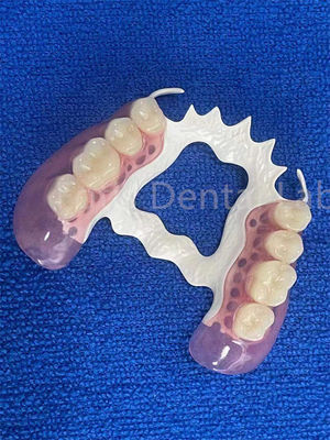 Chất chống vết bẩn Phần răng có thể tháo rời ổn định Thay thế răng giả bị thiếu