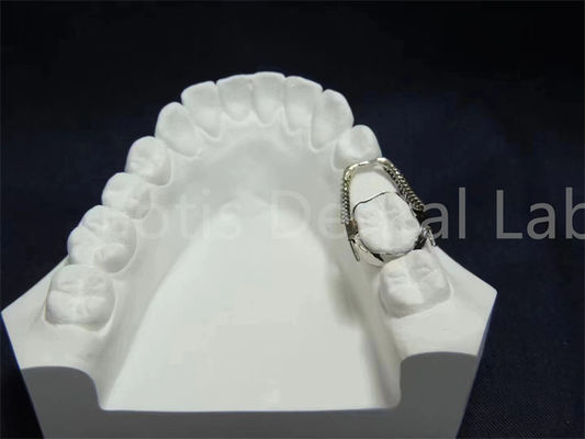 Bộ giữ có thể điều chỉnh, mở rộng, tiện lợi, giải pháp chỉnh nha dễ bảo trì