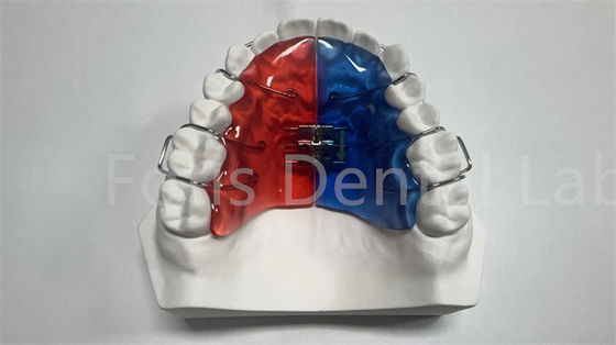 Máy mở rộng răng để sửa chữa và cải thiện răng