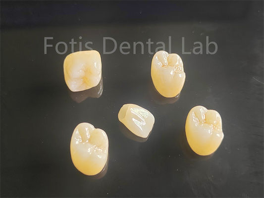 Sự hấp dẫn thẩm mỹ Full Porcelain Layered Zirconia lý tưởng cho cây cầu vương miện