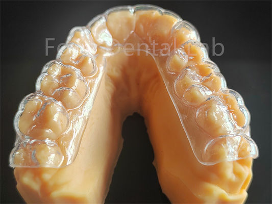 Tùy chỉnh bảo vệ răng cứng bảo vệ miệng cứng cho nghiền răng