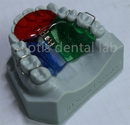 Máy mở rộng chỉnh sửa có thể tùy chỉnh và điều chỉnh để giữ răng hiệu quả
