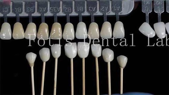Tùy chỉnh Dental veneers tự nhiên răng giả lớp phủ sức mạnh cao
