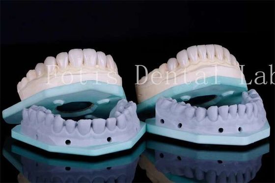 Vỏ răng chống vết bẩn Vỏ nha khoa Vỏ nha khoa 0.3mm-0.5mm Độ dày