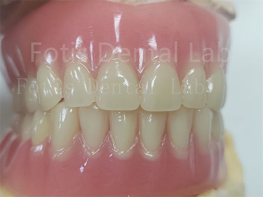 Sự thoải mái Tùy chọn phù hợp đầy đủ Acrylic răng giả cho răng giả chính xác
