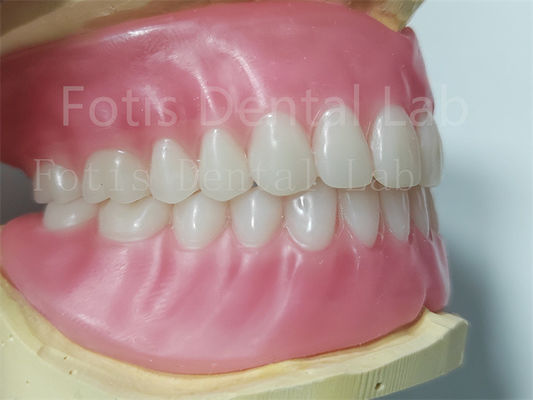 Răng Ivoclar Full Acrylic răng giả dễ làm sạch Độ bền cao