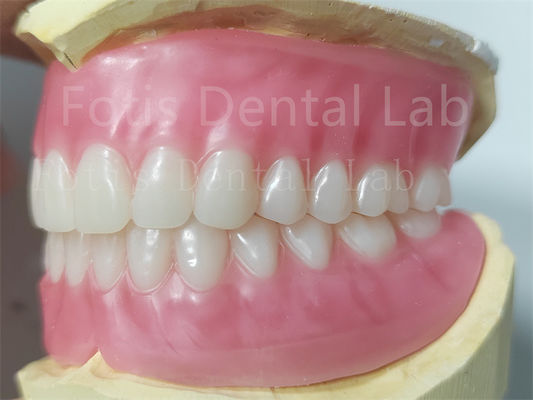 OEM Full Upper And Lower Acrylic Denture Kháng vết bẩn Màu sắc tự nhiên