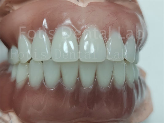 Denture Acrylic Full Upper thoải mái Denture Acrylic đầy đủ với răng Ivoclar