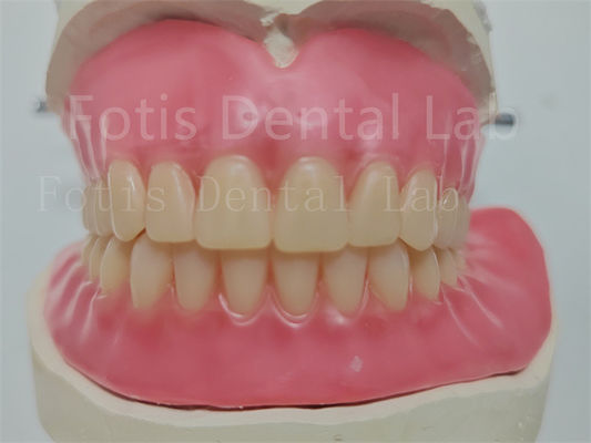 Giá cả phải chăng tùy chỉnh răng giả acrylic đầy đủ với răng Ivoclar dễ sử dụng