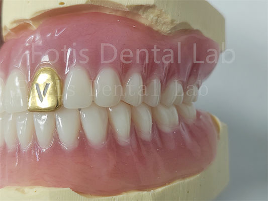 Tùy chỉnh răng giả đầy đủ Acrylic răng chống mùi thoải mái phù hợp
