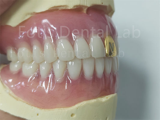 Esthetics Complete Acrylic Denture Set Phù hợp tùy chỉnh Dễ lau