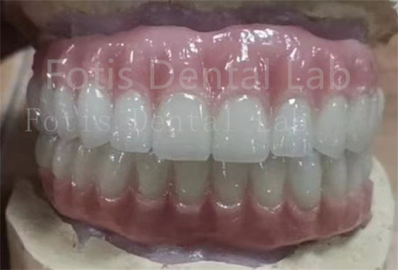 Chọn chính xác Ivoclar răng Acrylic hoàn chỉnh răng giả chống vết bẩn