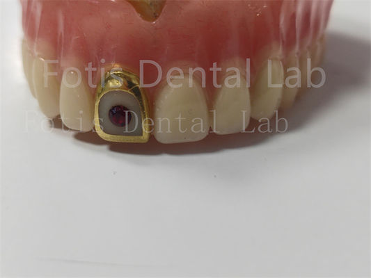 Denture Acrylic đầy đủ thoải mái cho các chuyên gia chống vết bẩn / mùi