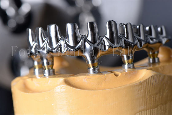 Long lasting Titanium / Zirconia All on 4 All on 6 implant Không giới hạn tuổi tác