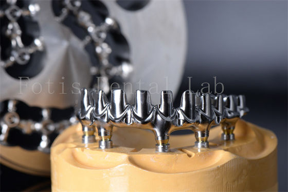 Tiến hành tái tạo nhai tất cả trên 4 tất cả trên 6 răng Titanium hoặc Zirconia