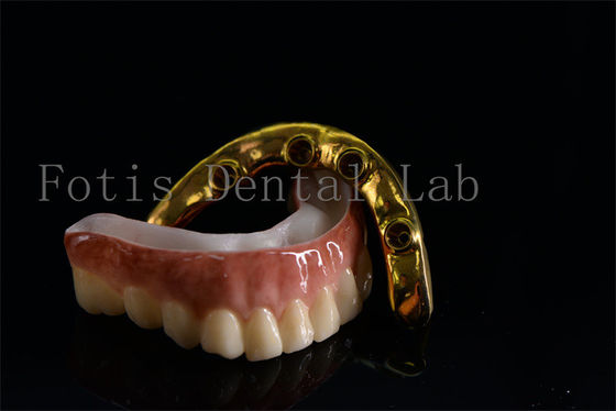Giá cả phải chăng All On Six Implants Điều trị hiệu quả Dễ lau