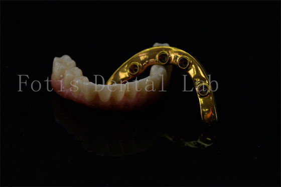 Titanium Zirconia tất cả trên 4 tất cả trên 6 cấy ghép nụ cười đầy đủ cấy ghép bảo hành trọn đời