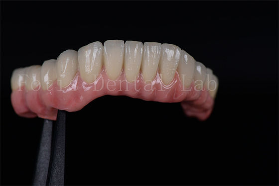 Tỷ lệ thành công cao tất cả trên bốn tất cả trên sáu Zirconia Titanium cấy ghép răng tùy chỉnh