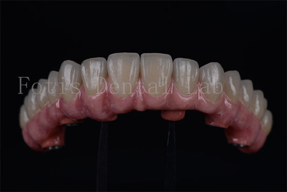 Titanium / Zirconia lâu dài tất cả trên 4 tất cả trên 6 phục hồi nhanh chóng 1-2 tuần