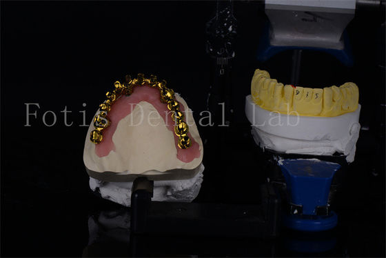 Giá cả phải chăng Titanium / Zirconia Tất cả trên 4 cấy ghép răng cho nụ cười trông tự nhiên