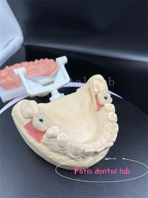 Chất liệu chính xác phù hợp đầy đủ miệng vương miện nha khoa dễ dàng đặt vương miện răng giả