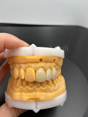 Chọn chính xác vương miện kỹ thuật số cấy ghép răng với tương thích chế độ truyền email