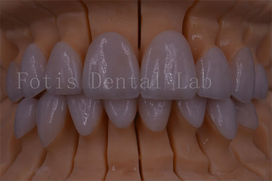 FDA / ISO / CE chứng nhận Vương miện kỹ thuật số răng Vương miện nhân tạo bất kỳ kích thước nào