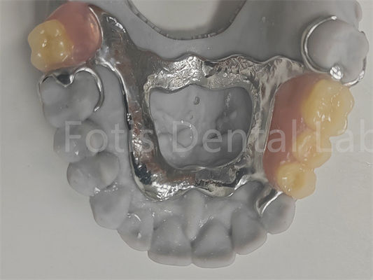 FDA dễ làm sạch răng giả có thể tháo rời tương thích với răng tự nhiên
