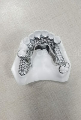 Độ ổn định cao răng giả linh hoạt dễ làm sạch Bảo trì thường xuyên