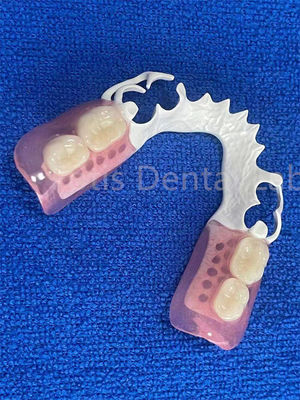 Chế tạo răng có thể điều chỉnh linh hoạt ổn định thoải mái ngay lập tức răng giả một phần