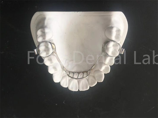 Chế độ mở rộng tùy chỉnh Palatal Expander Retainer Bảo trì dễ dàng