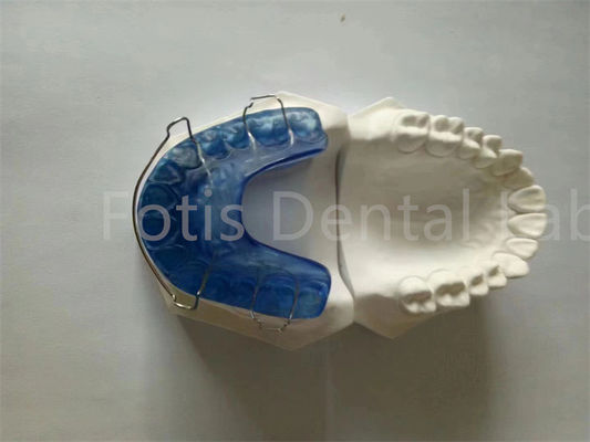 Dễ mặc nhanh Palatal Expander Retainer cho vệ sinh và thoải mái