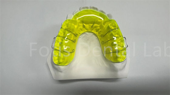 Thiết bị mở rộng giữ Miechigan an toàn / thiết bị cách răng chỉnh hình thuận tiện