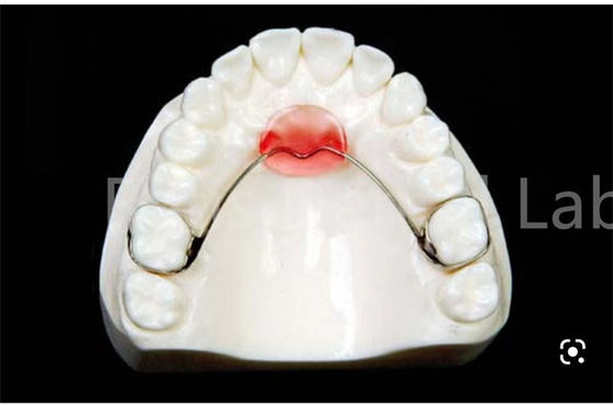 Bộ giữ mở rộng miệng điều chỉnh để giữ răng an toàn và mở rộng