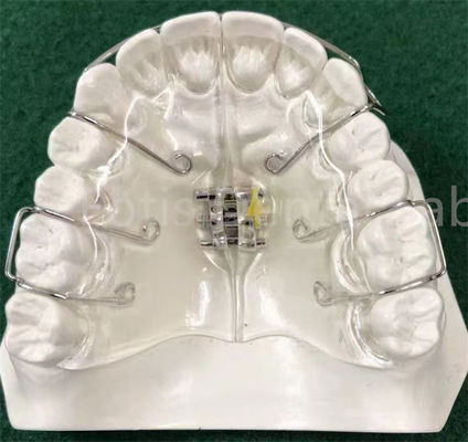 Thiết bị chỉnh nha mới nhất có thể tùy chỉnh