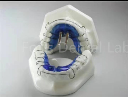Phương pháp điều trị chỉnh nha gia dụng cụ mở rộng để sắp xếp răng chính xác