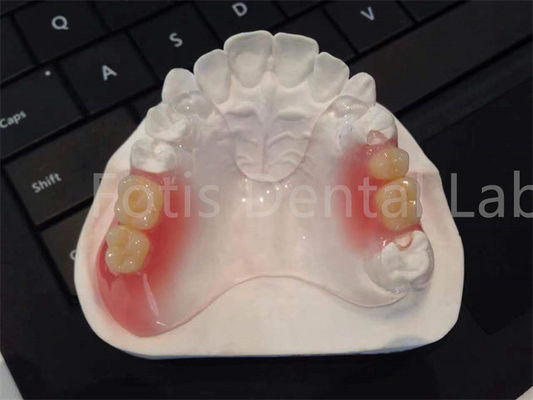 Dụng cụ nha khoa linh hoạt TCS Valplast thiết kế bền