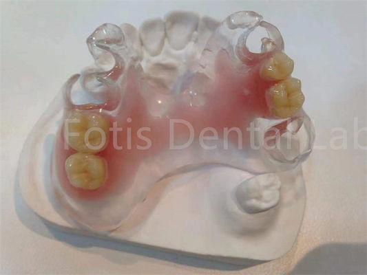 Phương pháp giả răng TCS Valplast chống vết bẩn Hypoallergenic để thoải mái lâu dài