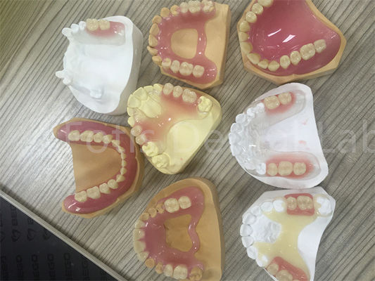 Denture linh hoạt TCS Valplast có thể tháo bỏ một phần dễ điều chỉnh