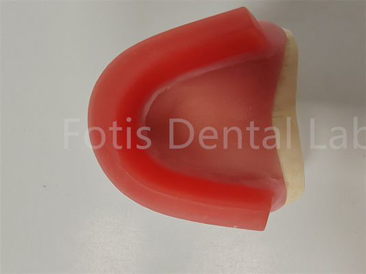 FDA phê duyệt Nhập ký cắn Wax Rims răng giả Occlusal Rim