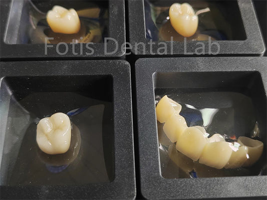 Phục hồi răng Zirconia Khả năng chống gãy nhiều lớp
