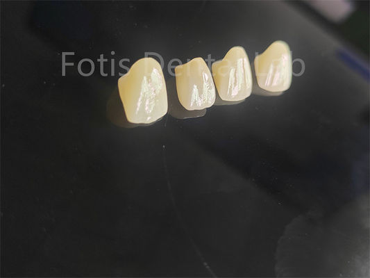 Đồ xốp chuyên nghiệp kim loại kim loại kim loại kim loại kim loại kim loại kim loại kim loại kim loại kim loại kim loại kim loại kim loại kim loại kim loại kim loại kim loại kim loại