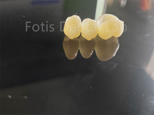 Ngành công nghiệp nha khoa Zirconia được lớp với đồ sứ giải pháp lâu dài