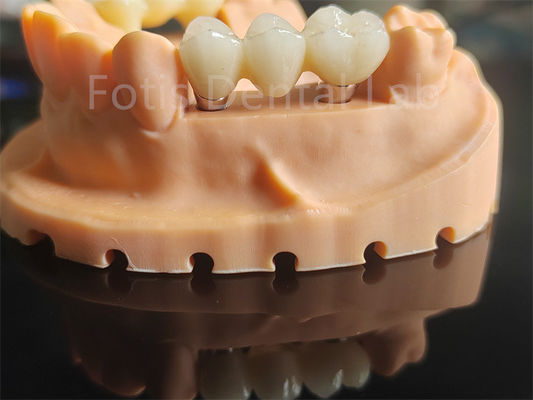 Vật liệu gốm dựa trên Zirconia có độ cứng cao cho các ứng dụng nha khoa