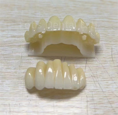 Sản phẩm đa lớp Zirconia chính xác để cải thiện khả năng chống gãy