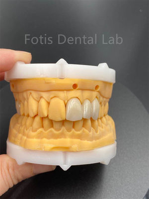 Các loại gốm nha khoa Zirconia nhiều lớp bền cao cho sản phẩm y tế phòng thí nghiệm nha khoa