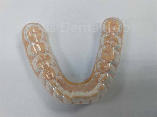 Bảo vệ đêm cứng mềm chuyên nghiệp Giữ răng của bạn khỏe mạnh Bảo vệ răng