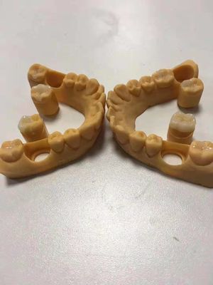 Đơn giản và chính xác, có thể tùy chỉnh